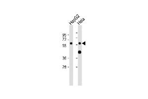 Western Blotting (WB) image for anti-Cytochrome P450, Family 7, Subfamily A, Polypeptide 1 (CYP7A1) (AA 27-58), (N-Term) antibody (ABIN6243133)