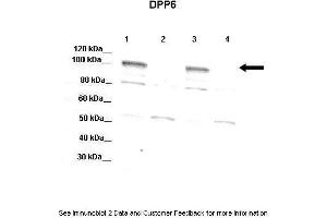 Lanes:   Lane 1: 20ug mouse WT brain extract  Lnae 2: DPP6 -/- mouse brain extract  Lane 3: 20ug mouse WT brain extract  4: DPP6 -/- mouse brain extract  Primary Antibody Dilution:   1:1000  Secondary Antibody:   Donkey anti-rabbit-HRP  Secondary Antibody Dilution:   1:10,000  Gene Name:   DPP6 a  Submitted by:   Jeanne M. (DPP6 抗体  (Middle Region))