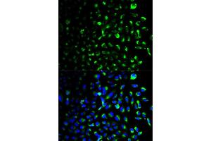 Immunofluorescence analysis of U2OS cell using HK1 antibody. (Hexokinase 1 抗体)