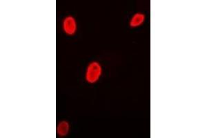 Immunofluorescent analysis of Brn-5 staining in MCF7 cells. (POU6F1 抗体)