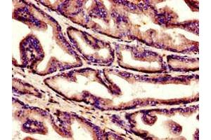 Immunohistochemistry of paraffin-embedded human prostate tissue using ABIN7148337 at dilution of 1:100 (C1QC 抗体  (AA 27-157))