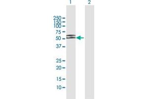 Western Blot analysis of PDHX expression in transfected 293T cell line by PDHX MaxPab polyclonal antibody. (PDHX 抗体  (AA 1-501))