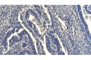 IHC analysis of HYI using anti-HYI antibody (ABIN7601796). (HYI 抗体  (AA 46-277))