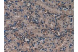 Detection of ND5 in Rat Kidney Tissue using Polyclonal Antibody to NADH Dehydrogenase 5 (ND5) (MT-ND5 抗体  (AA 425-562))