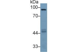 Western Blotting (WB) image for anti-Matrix Metallopeptidase 9 (Gelatinase B, 92kDa Gelatinase, 92kDa Type IV Collagenase) (MMP9) (AA 226-391) antibody (ABIN7427384)
