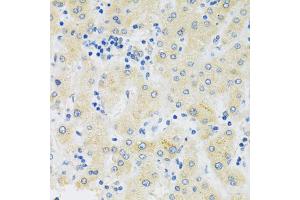 Immunohistochemistry of paraffin-embedded human liver using SLC39A7 antibody (ABIN5971725) at dilution of 1/100 (40x lens). (SLC39A7 抗体)