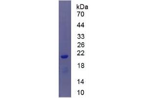 Western Blotting (WB) image for Interleukin 1, beta (IL1B) ELISA Kit (ABIN6574165)