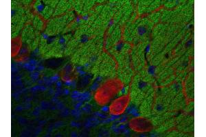 Immunohistochemistry (IHC) image for anti-Glycoprotein M6A (GPM6A) (AA 261-270) antibody (ABIN1742485) (GPM6A 抗体  (AA 261-270))