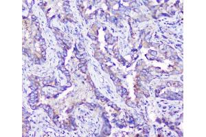 anti-Arylsulfatase A (ARSA) (AA 454-482), (C-Term) antibody