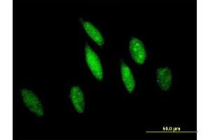 Immunofluorescence of purified MaxPab antibody to GSTO1 on HeLa cell. (GSTO1 抗体  (AA 1-241))