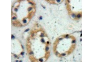 Used in DAB staining on fromalin fixed paraffin-embedded Kidney tissue (PIGR 抗体  (AA 230-331))