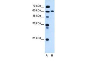 anti-Inositol 1,4,5-Triphosphate Receptor Interacting Protein-Like 1 (ITPRIPL1) (AA 402-451) antibody