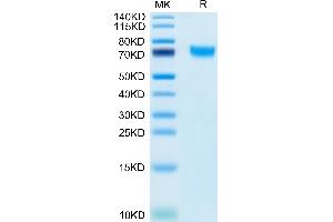 Human PLD4 on Tris-Bis PAGE under reduced condition. (Phospholipase D4 Protein (PLD4) (AA 52-506) (His tag))