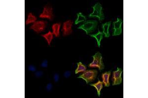 ABIN6261709 and ABIN6273117 staining Hela cells by IF/ICC.