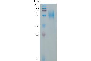 SDS-PAGE (SDS) image for B-cell antigen receptor complex-associated protein alpha chain (CD79A) (AA 33-143) protein (Fc Tag) (ABIN7538143)