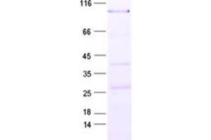 Validation with Western Blot