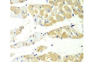 Immunohistochemistry of paraffin-embedded Mouse heart using TBXAS1 Polyclonal Antibody at dilution of 1:100 (40x lens). (TBXAS1 抗体)