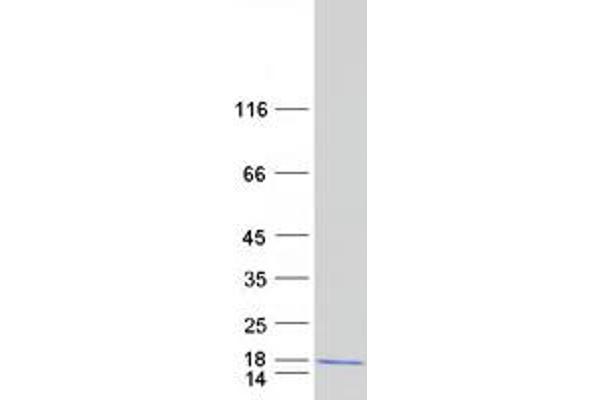 ADIG Protein (Myc-DYKDDDDK Tag)