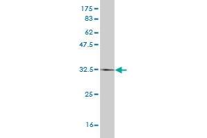 Western Blot detection against Immunogen (34. (HAND2 抗体  (AA 135-216))