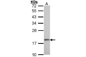 WB Image Sample (30 ug of whole cell lysate) A: A431 , 12% SDS PAGE antibody diluted at 1:1000 (RPS10 抗体)