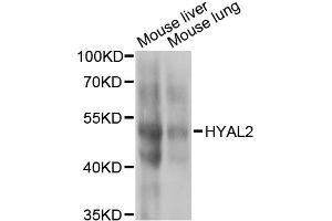 Western blot analysis of extracts of various cell lines, using HYAL2 antibody (ABIN2563308) at 1:1000 dilution. (HYAL2 抗体)