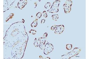 IHC analysis of Cyclophilin E/PPIE using anti-Cyclophilin E/PPIE antibody (ABIN7599243). (PPIE 抗体  (AA 1-301))