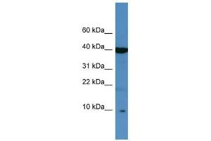 Western Blotting (WB) image for anti-serine Peptidase Inhibitor, Kazal Type 6 (SPINK6) (Middle Region) antibody (ABIN928823)