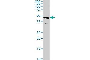 C17orf75 monoclonal antibody (M02), clone 2D7. (C17orf75 抗体  (AA 1-100))