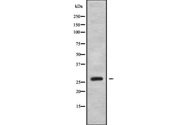 OTUB2 抗体  (Internal Region)