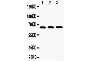 Anti-RANK antibody, Western blotting Lane 1: Recombinant Human RANK Protein 10ng Lane 2: Recombinant Human RANK Protein 5ng Lane 3: Recombinant Human RANK Protein 2. (TNFRSF11A 抗体  (N-Term))