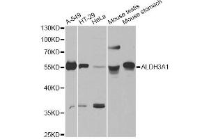 Western blot analysis of extracts of various cell lines, using ALDH3A1 antibody. (ALDH3A1 抗体)