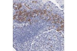 Immunohistochemical staining of human tonsil with LAX1 polyclonal antibody  shows cytoplasmic positivity in lymphoid cells outside reaction centra at 1:50-1:200 dilution. (LAX1 抗体)