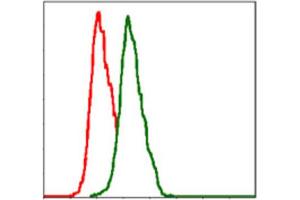 Immunohistochemical analysis of paraffin-embedded cervical cancer tissues using ITGB1 antibody with DAB staining. (ITGB1 抗体)