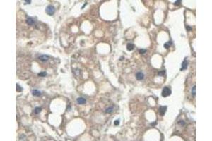 Immunohistochemical analysis of paraffin-embedded human fetal liver showing cytoplasmic staining with HINT2 polyclonal antibody  at a 1 : 100 dilution. (HINT2 抗体  (AA 59-163))
