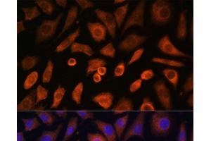 Immunofluorescence analysis of L-929 cells using N-WASP Polyclonal Antibody at dilution of 1:100 (40x lens). (Neural Wiskott-Aldrich syndrome protein (WASL) 抗体)