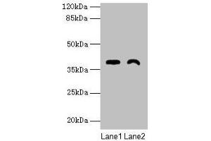 Western blot All lanes: TMEM255A antibody at 6 μg/mL Lane 1: Mouse stomach tissue Lane 2: Mouse heart tissue Secondary Goat polyclonal to rabbit IgG at 1/10000 dilution Predicted band size: 39, 21, 36, 27 kDa Observed band size: 39 kDa (FAM70A 抗体  (AA 110-225))