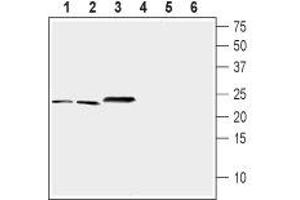 Western blot analysis of mouse brain (lanes 1 and 4), rat brain (lanes 2 and 5) and rat eye (lanes 3 and 6) lysates (1:200-1:400): - 1-3. (NCS1 抗体  (Intracellular))
