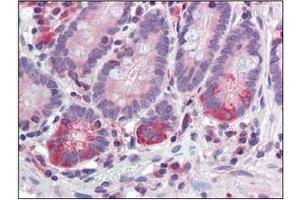 Immunohistochemistry (IHC) image for anti-Tyrosyl-DNA Phosphodiesterase 1 (TDP1) (AA 1-298), (N-Term) antibody (ABIN400858) (TDP1 抗体  (N-Term))