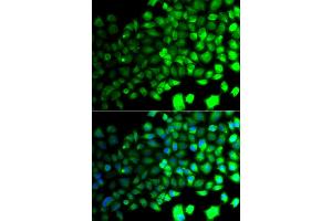 Immunofluorescence analysis of A549 cells using PRKAA2 antibody (ABIN5975502). (PRKAA2 抗体)