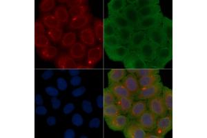 ABIN6260877 and ABIN6277178 staining Hela cells(30 min of UV treatment) by IF/ICC. (Claudin 1 抗体  (C-Term))