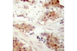 Immunohistochemistry (IHC) image for anti-Cyclin D3 (CCND3) (C-Term), (pSer283) antibody (ABIN7303698)