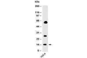 Western blot testing of human samples using SUMO1 antibody (SM1/495). (SUMO1 抗体)