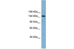 WB Suggested Anti-KIAA1199  Antibody Titration: 0. (CEMIP 抗体  (Middle Region))