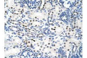 TROVE2 antibody was used for immunohistochemistry at a concentration of 4-8 ug/ml to stain Epithelial cells of renal tubule (arrows) in Human Kidney.