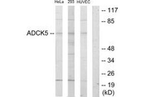 Western Blotting (WB) image for anti-AarF Domain Containing Kinase 5 (ADCK5) (AA 151-200) antibody (ABIN2889630) (ADCK5 抗体  (AA 151-200))