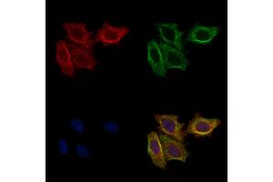 ABIN6261692 and ABIN6277568 staining HepG2 cells by IF/ICC.