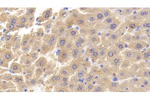 Detection of MCSFR in Mouse Liver Tissue using Polyclonal Antibody to Colony Stimulating Factor Receptor, Macrophage (MCSFR)