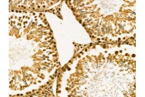 ABIN6257254 and ABIN6274135 at 1/100 staining Rat testis tissue by IHC-P.