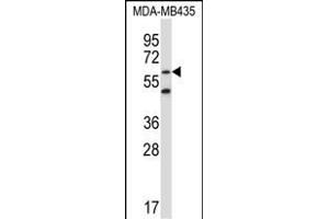 ZN Antibody (N-term) (ABIN657803 and ABIN2846776) western blot analysis in MDA-M cell line lysates (35 μg/lane).