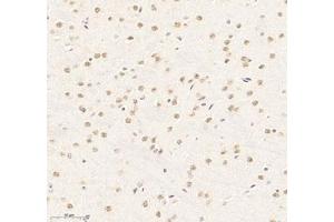 Immunohistochemistry of paraffin embedded mouse brain using RBM8A (ABIN7075478) at dilution of 1: 300 (300x lens)